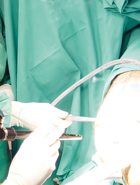 medicos realizando una cirugia en quirofano con uso de equipo especializado.