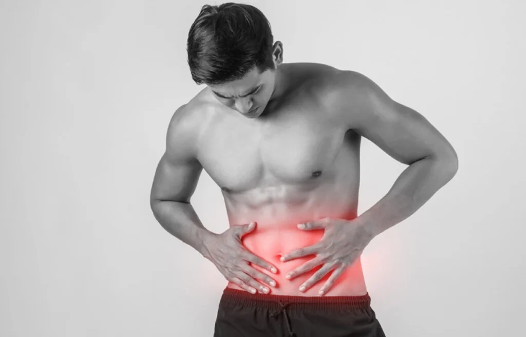 síntomas de hernia abdominal